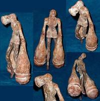 Closer (Silent Hill) Custom Action Figure